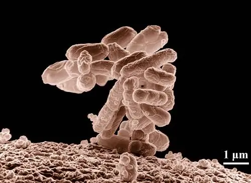 Группа бактерий Escherichia coli, увеличение в 10 000 раз. Группа бактерий Escherichia coli, увеличение в 10 000 раз.