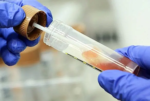 кредит: Шон Гэллап / Getty Images Новости / GettyImages