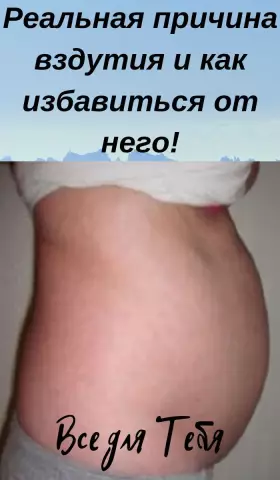 Здоровье Обсуждение: Кошки могут выражать поведение, как человеческое ОКР