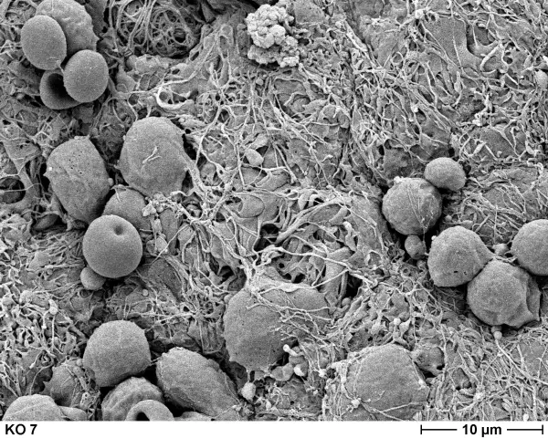 Может ли Dewormers вызвать изъятия?