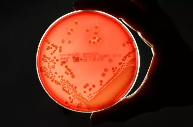 Является ли Superbug опасностью для людей?