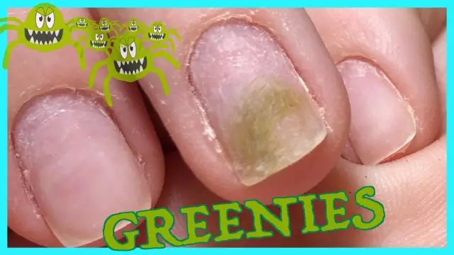 Greenies -Pro или Con?