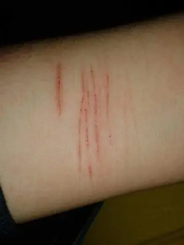 Как быстро избавиться от кошачьих царапин?