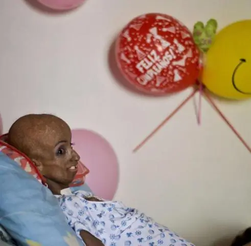 Чем становятся глоточные мешки у человека?