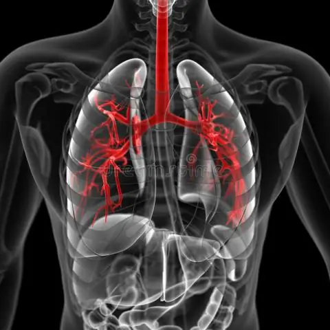 Где находится Целом?