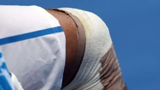 Как лечить гниль бетта-плавников?