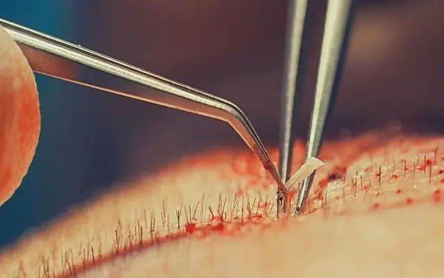 Можно ли пересаживать кордилины?