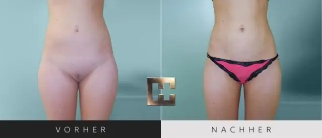 Сколько стоит уничтожение блох?