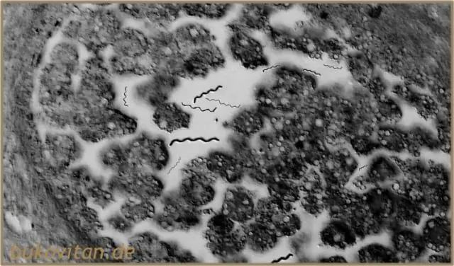 Как получить wuchereria Bancrofti?