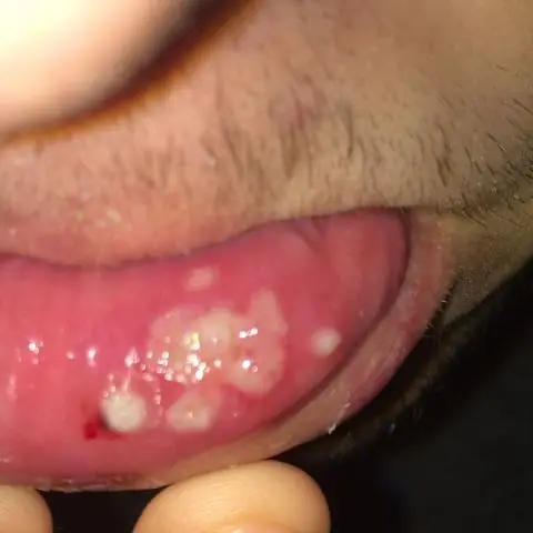 Как избавиться от кротовых сверчков?