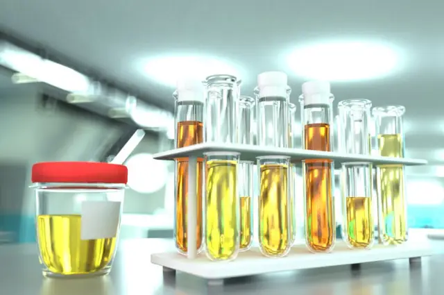 Разнообразные природные жирные кислоты следуют «золотой середине»: ученые-биоинформатики рассчитывают количество теоретически возможных жирных кислот с помощью последовательности Фибоначчи