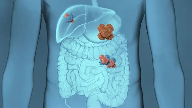 Парные мутации: новый подход к обнаружению формы белков: новое исследование описывает инновационный подход к определению модульной структуры белков по информации об их единственной последовательности