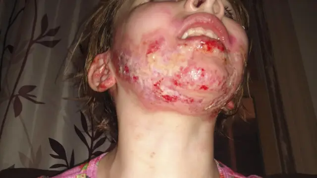 Ужасная стратегия спаривания, по-видимому, приносит пользу как самцам, так и самкам красноспинных пауков: самцы ищут неполовозрелых самок, чтобы их не съели заживо, но исследования показывают, что сам