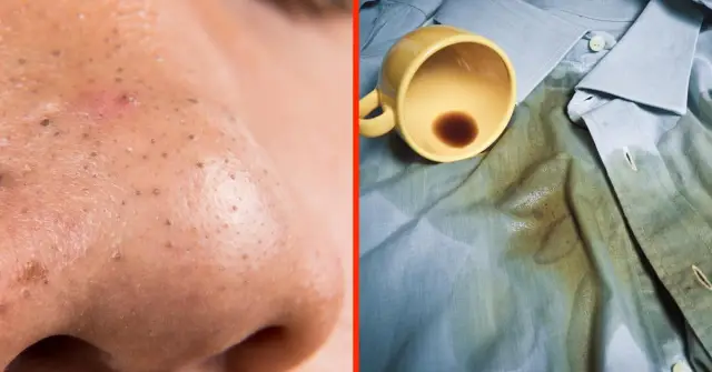 Исследование предлагает метод для ускорения роста кровеносных сосудов и мышц: активация белков, связанных с долголетием, может помочь повысить выносливость и бороться со слабостью у пожилых людей