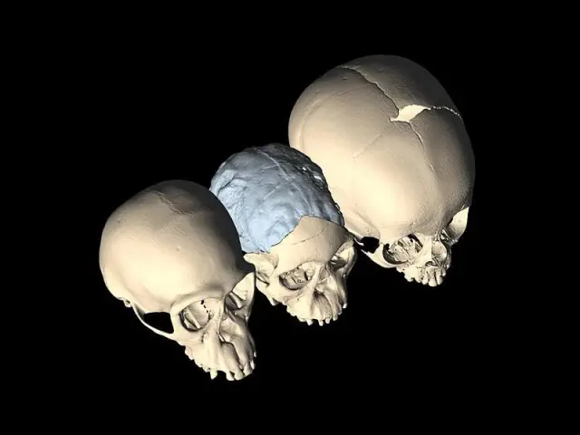 Череп гоминина возрастом четыре миллиона лет показывает сходство с черепом современного человека: «виртуальное» повторное посещение окаменелости, описанной как «старейшее свидетельство эволюции челове