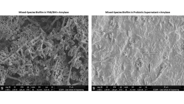 Запатентованный пробиотик может разрушить биопленки болезни Крона: обнаружено, что пробиотик помогает ослабить стойкие сообщества микробных биопленок в кишечнике, которые могут ухудшить симптомы