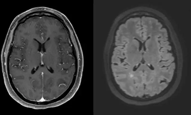 Ледяные керны показывают медленное снижение содержания кислорода в атмосфере за последние 800 000 лет