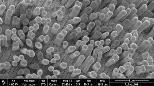Нетрадиционное деление клеток в Карибском море: бактерия ломает догму клеточной биологии