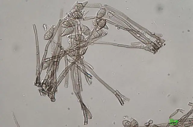 Жуткое новое грибковое заболевание на южных полях для гольфа разоблачено