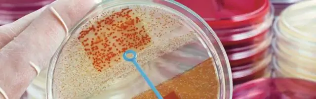 Бактерии с множественной лекарственной устойчивостью от кур представляют опасность для здоровья человека