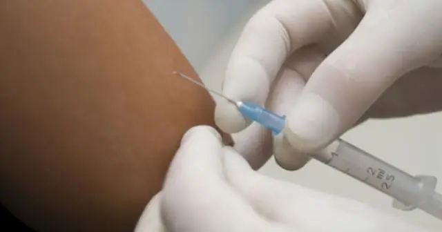 Люди распознают частично скрытых змей легче, чем других животных