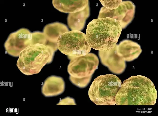Понимание пресловутой инфекционности Francisella tularensis: новый подход к старой проблеме дает ключ к пониманию вирулентности туляремии