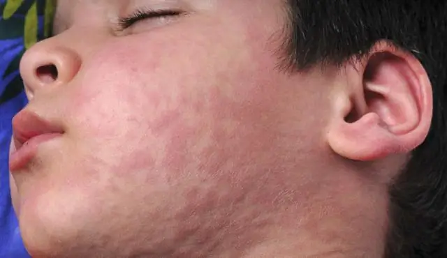 Биологи используют «ископаемые» подсказки, чтобы точно определить, когда предки млекопитающих, птиц и динозавров стали спортсменами