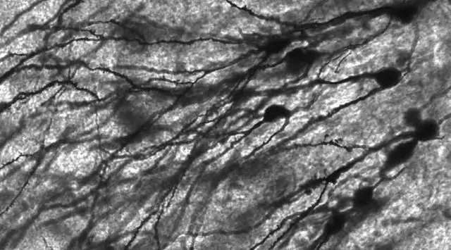 Отростчатые клетки, используемые для разрушения поврежденных органелл, теперь идентифицированы