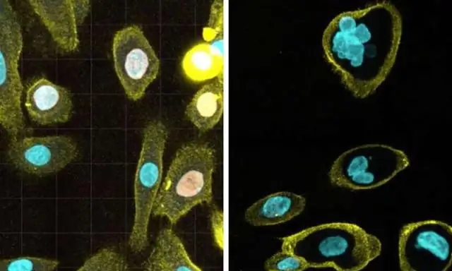 Обнаружен главный регулятор клеточного старения