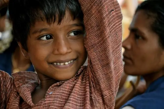 Ограничение калорий позволяет обезьянам жить долго и процветать