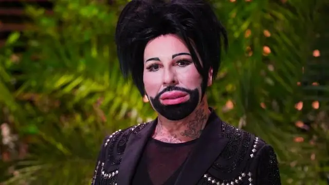 Какой будет осиная чума в этом году?