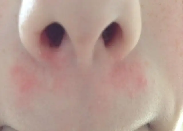 Новая методика позволяет быстро предсказать уязвимость солончаков: исследователи обнаружили, что все 8 оцененных болот атлантического и тихоокеанского побережья теряют свои позиции