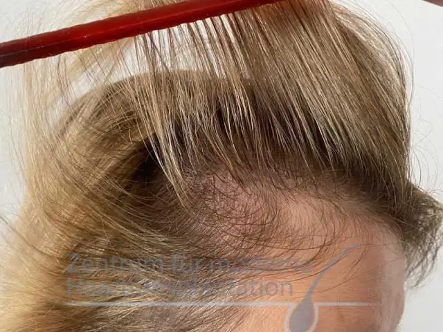 Важные экосистемы подводных каньонов находятся под угрозой