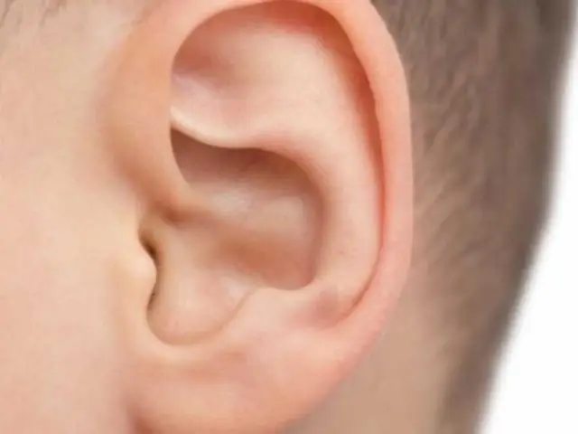 Положительные долгосрочные результаты операции по поводу колик у лошадей