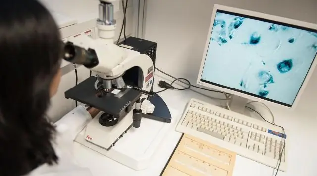 Клеточное старение предотвращается ферментом SETD8