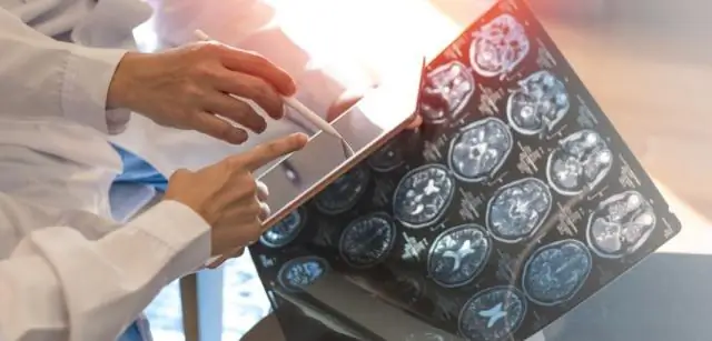 Новый тест выявляет раннюю стадию истощения у крупного рогатого скота