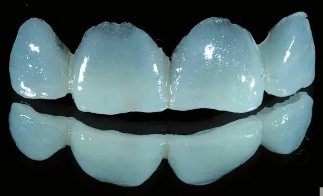 Сильное взаимодействие между травоядными и растениями: новое исследование раскрывает важный механизм, ответственный за биоразнообразие в природных экосистемах