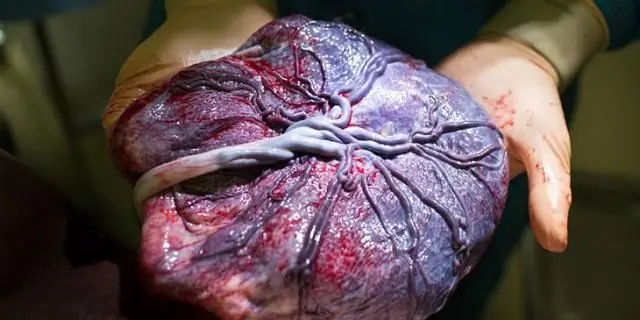 Не дать вирусу Зика проникнуть через плаценту