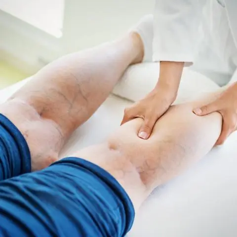 Проблема для производителей авокадо усугубляется: 9 видов жуков переносят смертельный грибок