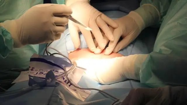 Дети подвержены большему риску осложнений от укусов коричневого паука-отшельника