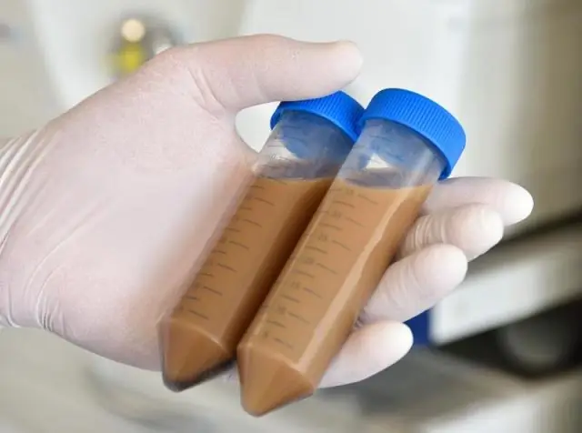 Лямблиоз может быть заболеванием экологии желудочно-кишечного тракта