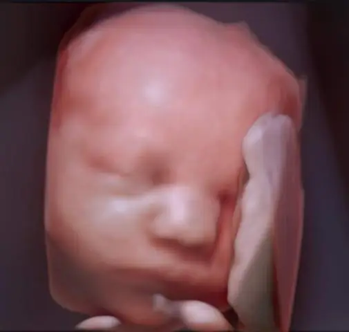 Рост клеточных стенок растений, который растягивается, но не ломается, сложнее, чем считалось ранее