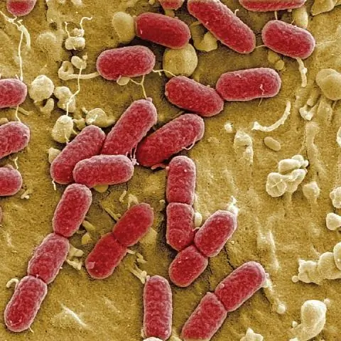 Уничтожение бактерий дезинфицирующими средствами из бумаги: команда изобретает многообещающую технологию уничтожения микробов