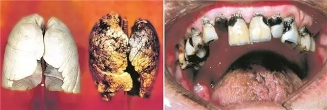 Жестокая брачная битва между дикими каракатицами