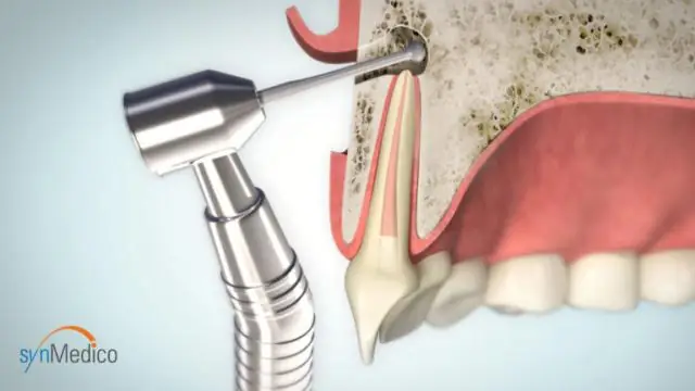 Микроскопические почвенные существа могут организовать массовую миграцию деревьев