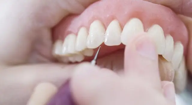 «Молекулярные протезы» могут заменить недостающие белки для лечения болезней