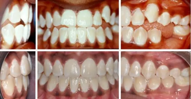 Извлечение фенолов из кожуры винограда, косточек, оптимизированное