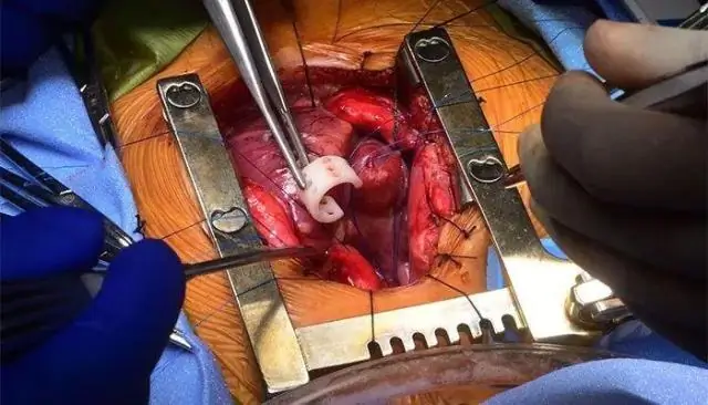 Испытан датчик качества воды, напечатанный на 3D-принтере: недорогие и крошечные устройства проверяют качество воды в системе распределения