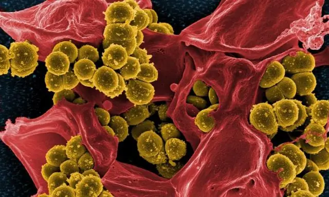 Даже у бактерий есть багаж, и понимание этого является ключом к борьбе с супербактериями