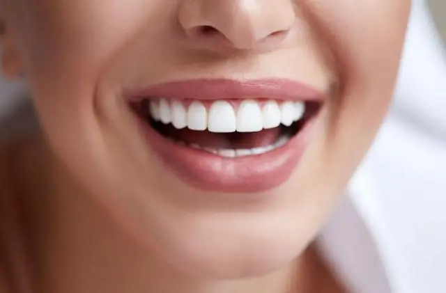 Более прочный зуб: новый композит для реставрации зубов оказался более долговечным, чем обычный материал